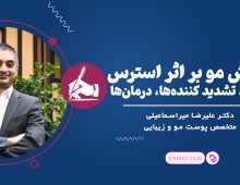 ریزش مو بر اثر استرس: دلایل، تشدید کننده‌ها، درمان‌ها